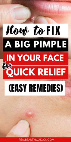 Generated Description with relevant hashtags. Overnight Pimple Remedies, Zit Remedy, Get Rid Of Pimples Overnight, Rid Of Pimples Overnight, Inflamed Pimple, Painful Pimple, Redness Pimple, Big Pimple, How To Clear Pimples