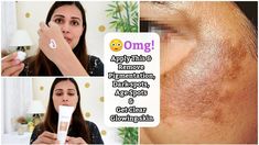 How To Reduce Dark Eye Circles Pigmentation Remedy, Under Eye Circles, Ayurvedic Skin Care, Dark Eye Circles, Natural Face Skin Care, Clear Glowing Skin, Dark Under Eye