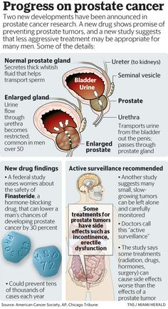 In October, the FDA approved High Intensity Focused Ultrasound to treat prostate cancer, nearly two decades after it was approved by regulators in Asian and European countries. Types Of Cancers, European Countries, Fda Approved, Ultrasound, How To Stay Healthy, The Well, Health Tips, Health