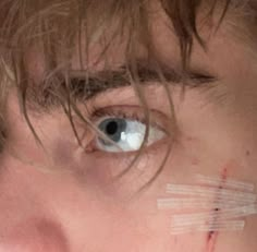 a close up of a person's eye with tape on it