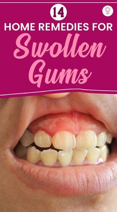 #WhyIsOralCareImportantInHospitals Swollen Gum, Improve Nutrition, Dental Cavities, Teeth Health, Gum Care, Receding Gums, Gum Health, Oral Health Care, Beyond Words