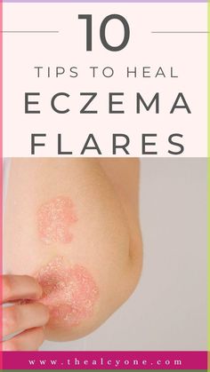 Struggling with eczema flare-ups? Discover 10 proven tips to soothe irritated skin and heal eczema fast. From skincare routines to natural remedies, these expert-backed strategies will help you manage and calm flare-ups effectively. Click to start your journey to healthier, happier skin! Age Spot Remedies, Cough Natural Remedies, Cough Syrup Recipe, Itchy Rash, Health Herbs, Ice Pick, Severe Acne, Holistic Beauty, Syrup Recipe