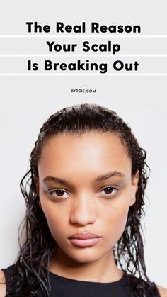 We asked dermatologists why pimples can crop up on the scalp—and how to get rid of them for good. Read on for how to treat scalp breakouts at home and when to see an expert. Scalp Pimples, Pimples On Scalp, Comedonal Acne, Scalp Acne, Head Acne, Blind Pimple, Pimples Under The Skin, Embracing Diversity, Pimples Overnight