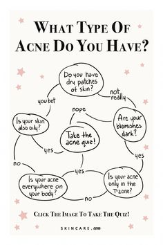 Not sure what type of acne you have or how to treat it? Take this quick and easy quiz to find out how to get rid of the most common types of acne. Facial Warts, Acne Scar Remedies, Different Types Of Acne, Anti Aging Skin Care Diy, Blind Pimple, Pimples Under The Skin, Skin Bumps, Types Of Acne, Glow Skin