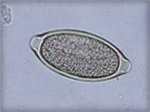 an animal cell is shown in this image, it appears to be small and tiny