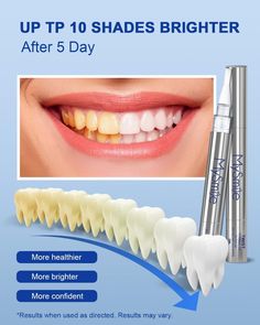 Achieve a noticeably whiter smile in minutes with our teeth whitening pen. Instantly achieve a whiter smile with our powerful teeth-whitening pen. The precise brush tip allows for easy application to target specific areas, with no mess or fuss. Formulated with dental-grade ingredients, this pen is gentle on enamel while delivering impressive results for a long-lasting, radiant smile. Hydrogen Peroxide Teeth, Hydrogen Peroxide Teeth Whitening, Peroxide Teeth Whitening, Listerine Cool Mint, Antiseptic Mouthwash, Get Whiter Teeth, Whitening Strips, Teeth Whitening Gel, Teeth Whitening Pen