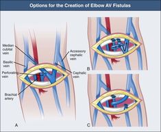 an image of the anatomy of the eye and its surrounding areas, including the iris