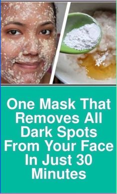 This Secret Ingredient Remove Wrinkles Easily at Home \u003e\u003eCHECK IT OUT\u003c\u003c Natural Wrinkle Remedies, Dark Spots Remedies, Anti Aging Skincare Routine, Wrinkle Remedies, Wrinkle Free Skin, Dark Spots On Face, Face Scrub Homemade, Spots On Face, Face Wrinkles