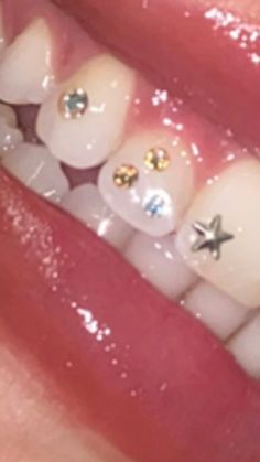 Tooth Gem Designs, Teeth Jewels, Tooth Gems Ideas, Bottom Teeth, Y2k Tattoo, Tooth Jewelry, Pretty Piercings, Braces Colors