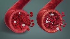 What is the Difference Between Vasovagal Syncope and Hypoglycemia Check more at https://in4arts.com/what-is-the-difference-between-vasovagal-syncope-and-hypoglycemia.html High Blood Sugar Symptoms, High Blood Sugar Levels, Low Blood Sugar, Sugar Level, Blood Glucose Levels, Glucose Levels, Regulate Blood Sugar, High Blood Sugar, Health Board