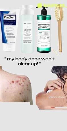 Products For Clear Skin, Create Pin, Acne Body Wash, Haut Routine, Skin Care Basics, Clear Healthy Skin, Beautiful Skin Care