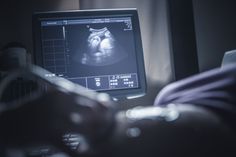 a person is looking at an x - ray image on a computer screen