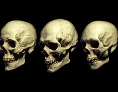 three different views of the same human skull