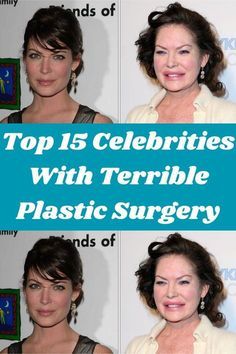 the top 15 celebrities with terrible plastic surgery