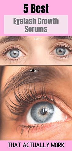 Long Natural Eyelashes, Diy Eyelash Growth Serum, Natural Long Eyelashes, Eyelash Serum, Eyelash Growth, Natural Eyelashes