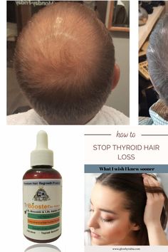 how to fix damaged hair Fix Damaged Hair, Damaged Hair Diy, Hair Regrowth, I Wish I Knew, Damaged Hair, Homemade Recipes, Health, Hair