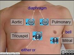 the diagram shows different types of diaphragm and fibrosis in men