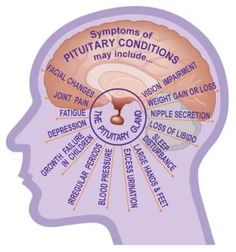 Hormone Imbalances and Syndromes in Mold-Injured Patients Pituitary Adenoma, Pituitary Gland Tumor, Pituitary Tumor, Tummy Issues, Chiari Malformation, Nursing Mnemonics, Health Medicine, Adrenal Support, Pituitary Gland