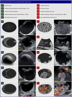 an image of different types of mri images