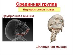 an image of a skeleton with the words in russian