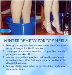 How To Make Your Feet Pretty Tips, How To Make Feet Soft, How To Make Feet Soft And Smooth, Feet Care Tips, Dry Heel Remedies, Foot Soaks, Dry Heels, Foot Scrub