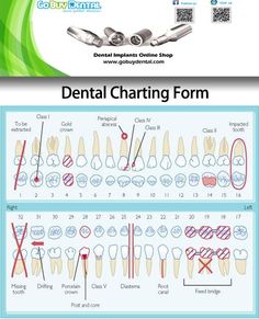 Dental Assistant Study Charting, Dental Codes Cheat Sheet, Dental Charting Abbreviations, Dental Assistant Cheat Sheet, Dental Xrays Tips, Dental School Notes, Dental Assistant Instructor, Dental Assistant Notes, Dental Assistant Tips