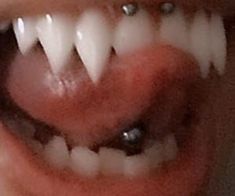 an open mouth with white teeth and metal studs