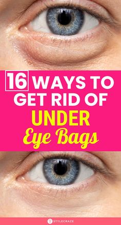 Droopy Eyelids, Health And Fitness Magazine, Under Eyes, Dark Circles Under Eyes, Sciatic Nerve