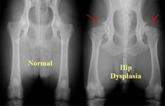 an x - ray shows normal hip dysplasia and hip dysplasia