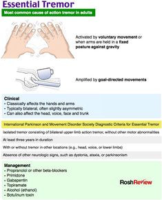 a poster with instructions on how to use the treatment technique for acne prone hands