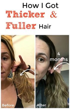 How I Got Thicker, Fuller Hair in 4 Months NATRUALLY! Healthier, stronger hair without buying anything expensive. No funny oils, drugs or medications. Grow Hair Back, Ways To Grow Hair, Thicker Hair Naturally, Make Hair Thicker, Get Thicker Hair, Help Hair Grow, Thicker Fuller Hair, Stronger Hair