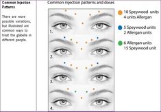 Botox Forehead, Botox Training, Aesthetic Treatments