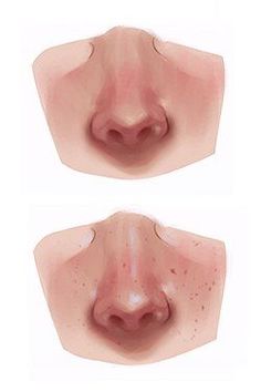 three different angles of the nose and mouth