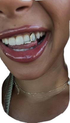 Crest Teeth Whitening Strips, Girl Grillz, Teeth Grills, Pretty Teeth, Dental Jewelry, Grillz Teeth, Teeth Caps, Gold Grill, Ugg Classic Mini Ii