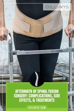 Aftermath of Spinal Fusion Surgery Complications, Potential Side Effects, Treatments Sciatic Nerve Relief, Sciatic Nerve Pain Relief, Spinal Injury