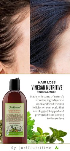 My hair is very thin and I have quite a few almost bald spots. It's possible this is medicine related, but it doesn't matter because I use this rinse every 4 days along with the hair fall conditioner and I am so excited to say that I have hair growing back! I can see and feel a difference. Grow Hair Back, Just Nutritive, Growing Hair, Hair Growing, Mens Haircut, Baking Soda Shampoo, Hair Remedies, Penteado Cabelo Curto, Hair Fall