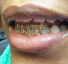 a close up of a person's mouth with gold teeth and hearts on it