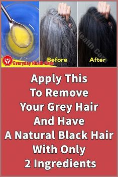 Grey Hair Remedies, Prevent Grey Hair, Umgestaltete Shirts, Heath Care, Natural Gray Hair, Hair Remedies, Hair Starting