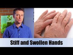 Stiff Hands Remedy, Swollen Hands Remedy, Swollen Hands, Sweaty Hands