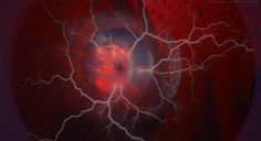 an eyeball is shown with red and white lightening in the middle of it