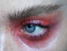 an eye with red and black spots on it