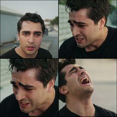 four different shots of a man with his mouth open and teeth wide open, looking up at the camera