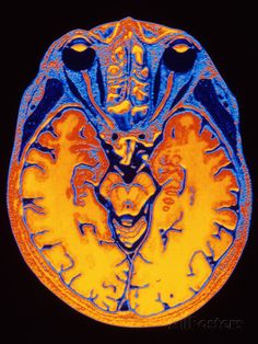 an image of the brain in blue and yellow