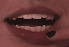 K9 Teeth Human Aesthetic, Teeth Aesthetic Grunge, Shifting Feature Claims, Cute Teeth Aesthetic, Teeth Claims For Dr Sharp, Pretty Teeth With Fangs, Natural Sharp Teeth, Dr Scar Claims, Sharp K9 Teeth Human