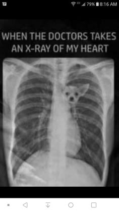 an x - ray image shows the chest and ribs with words written on it that read, when the doctors takes an x - ray of my heart