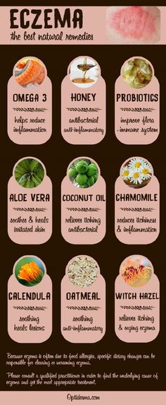 Effective and Natural Eczema Remedies Natural Healing Remedies, Acne Remedies, Natural Therapy, Skin Healing, Natural Home Remedies, Natural Treatments, Health Remedies, Natural Healing, Probiotics