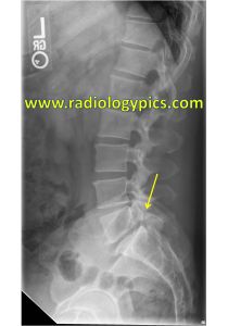 an x - ray shows the radiograph of a man's back and chest