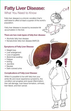 Discover 7 natural remedies to help manage and reverse fatty liver disease. From incorporating liver-friendly foods like leafy greens and garlic to using herbal supplements and staying active, learn how simple lifestyle changes can reduce liver fat, improve function, and promote overall health. Start supporting your liver naturally today! Fennel Essential Oil, Liver Care, Low Estrogen Symptoms, Natural Cleaning Solutions, Liver Function, Ginger Essential Oil, Scar Tissue, Hormone Health