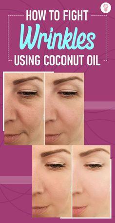 Eliminate Wrinkles, Diy Coconut Oil, Wrinkle Reduction, Coconut Oil For Face, Benefits Of Coconut Oil, Anti Wrinkle Cream, Deep Wrinkles, Natural Moisturizer