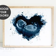 Watercolor ultrasound art in heart shape Ultrasound Art, Baby Ultrasound, Baby Boy Nursery Decor, Personalized Baby Shower Gifts, Angel Baby, Watercolor Sunflower, Personalized Baby Shower, Baby Keepsake, Balloon Art